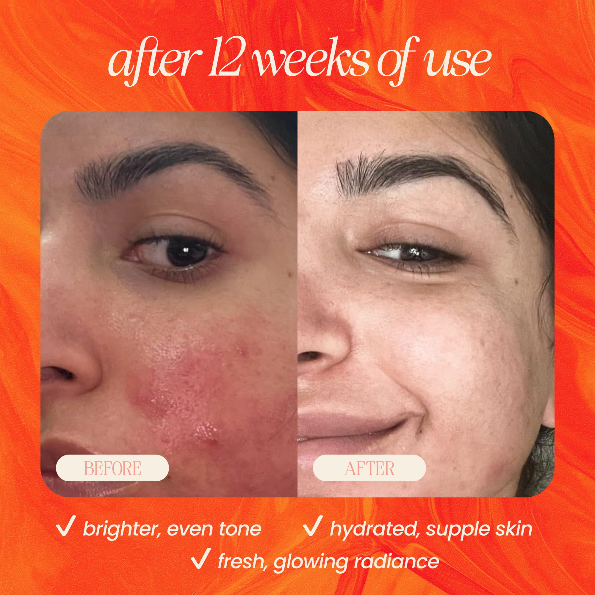 Pineapple & Rosehip Vitamin C Serum